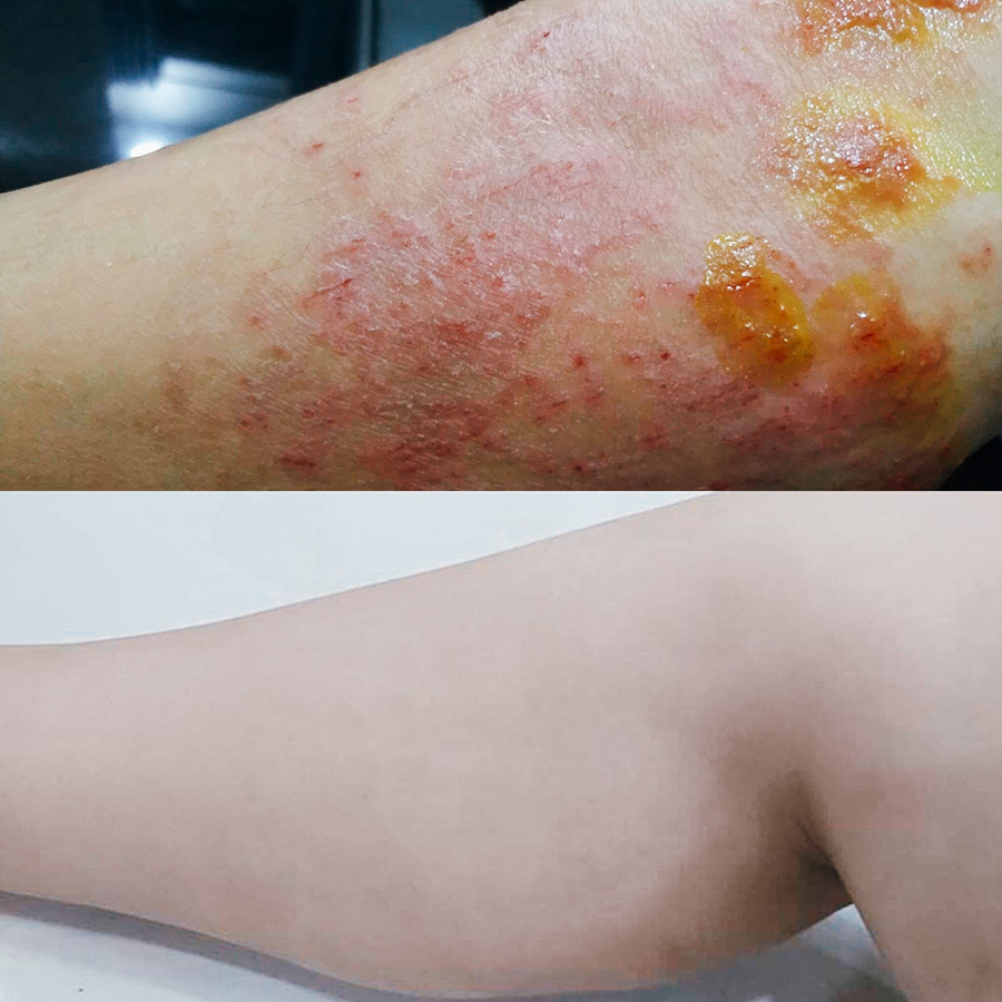 Anh Đào là ai? Anh Đào đã cải thiện sức khỏe bằng cách nào?, PlansbyAnh