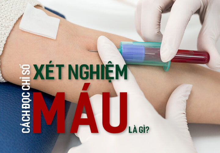 Xét nghiệm máu là gì? Cách đọc chỉ số xét nghiệm máu.