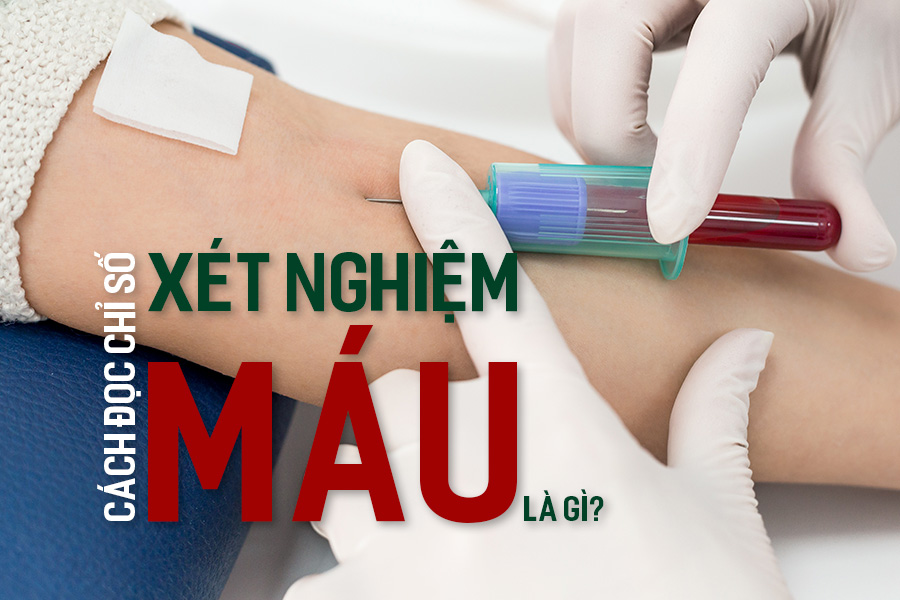 Xét nghiệm máu là gì? Cách đọc chỉ số xét nghiệm máu.